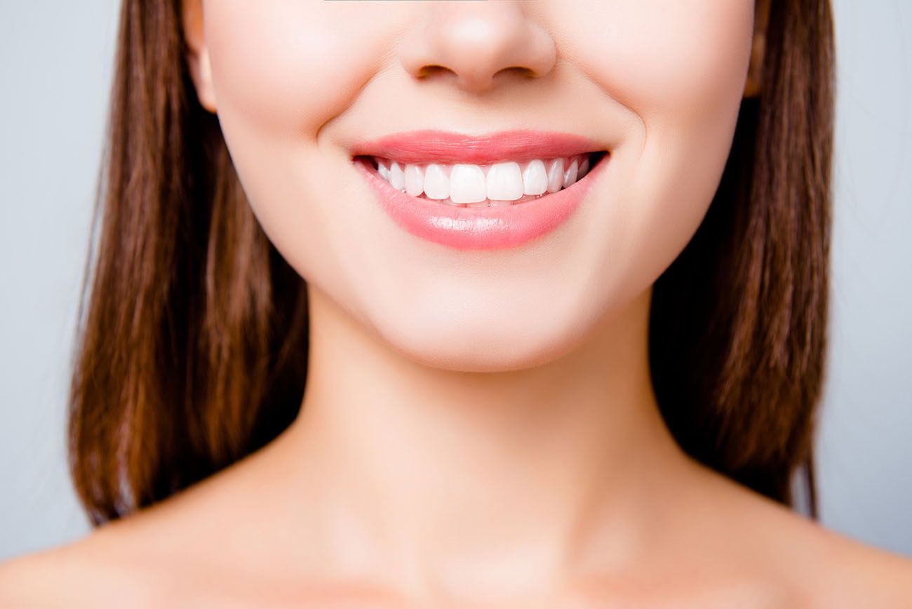 Porcelain Veneers Iowa City IA | Dental Veneers | Teeth Veneers